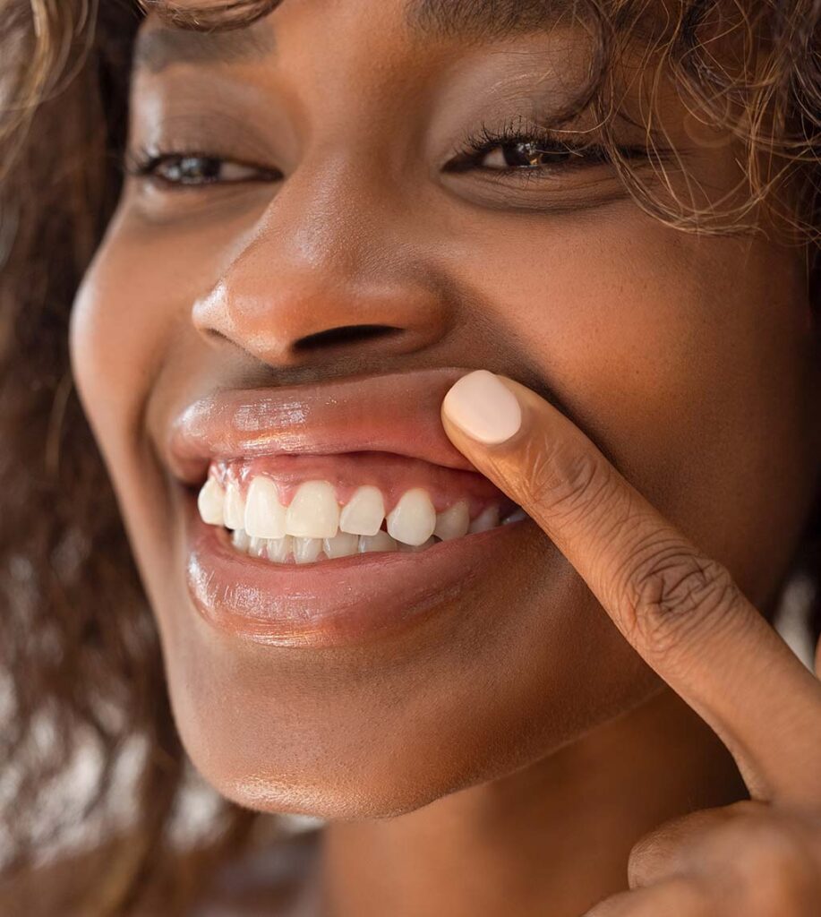 Patient showing her beautiful smile after gum contouring treatment at Fay Periodontics, demonstrating the aesthetic benefits of precise periodontal care